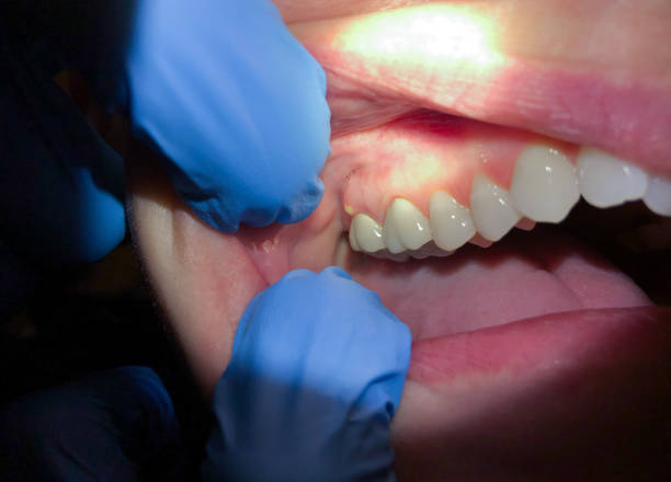 Best Emergency Gum Pain Relief  in Valley, NE